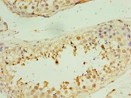 Polyclonal Rabbit anti-Human STX3 / Syntaxin 3 Antibody (aa1-263, IHC)