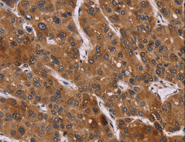 Polyclonal Rabbit anti-Human PPIB / Cyclophilin B Antibody (IHC, WB)