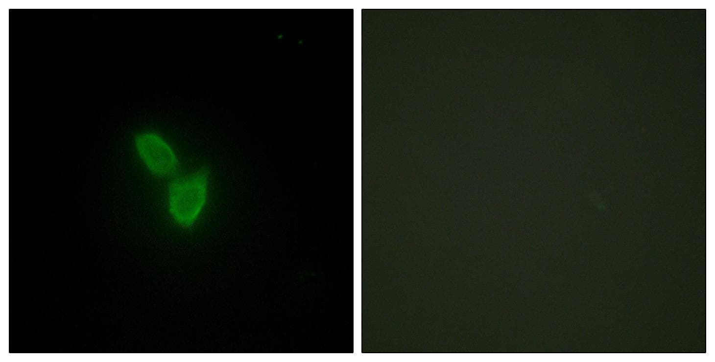 Polyclonal Rabbit anti-Human PARD3 Antibody (IF, WB)