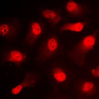 STAT1 Antibody (phospho-Ser727)