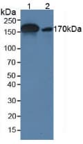A2M / Alpha-2-Macroglobulin Antibody (APC)
