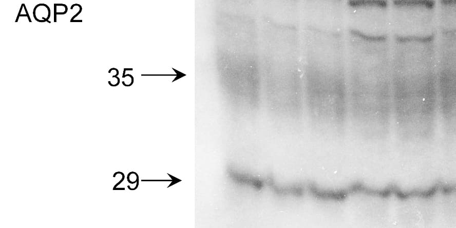 AQP2 / Aquaporin 2 Antibody