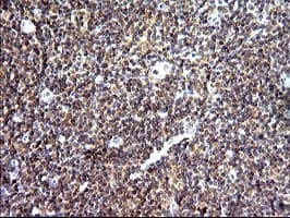 SHBG Antibody (clone OTI1D10)