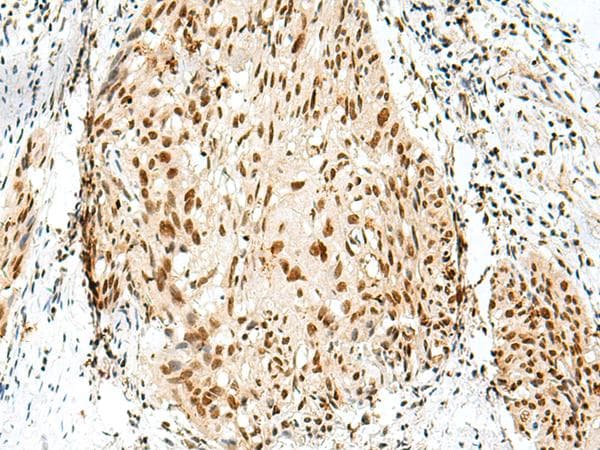 Polyclonal Rabbit anti-Human RBM10 Antibody (IHC)