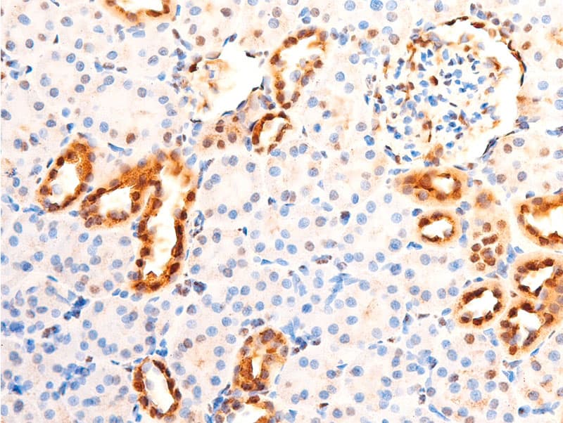 JUN / c-Jun Antibody (phospho-Ser63)