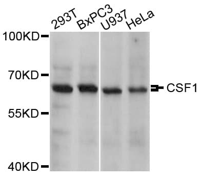 Polyclonal Rabbit anti-Human CSF1 / MCSF Antibody (IHC, IF, WB)