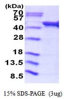 E. coli ackA Protein (Recombinant His)