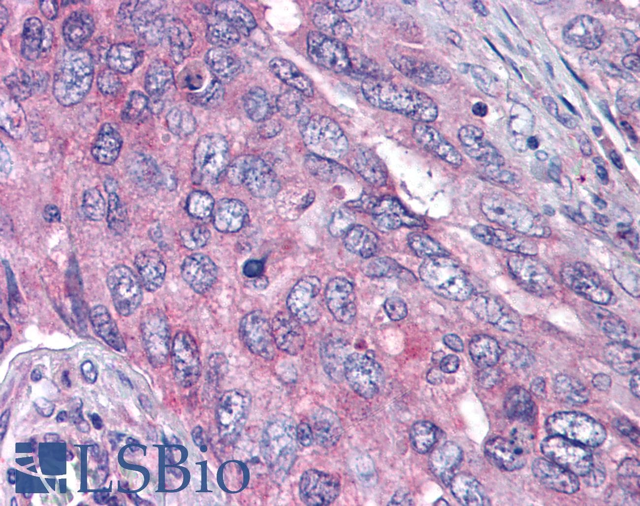 IHC-plus™ Polyclonal Rabbit anti-Human PLK1 / PLK-1 Antibody (phospho-Thr210, IHC, WB)