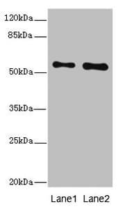Polyclonal Rabbit anti-Human RPS6KL1 Antibody (IHC, WB)