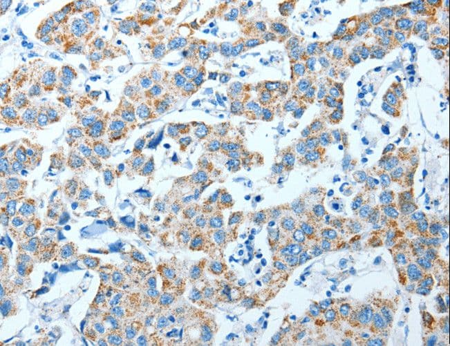 P5CDH / ALDH4A1 Antibody