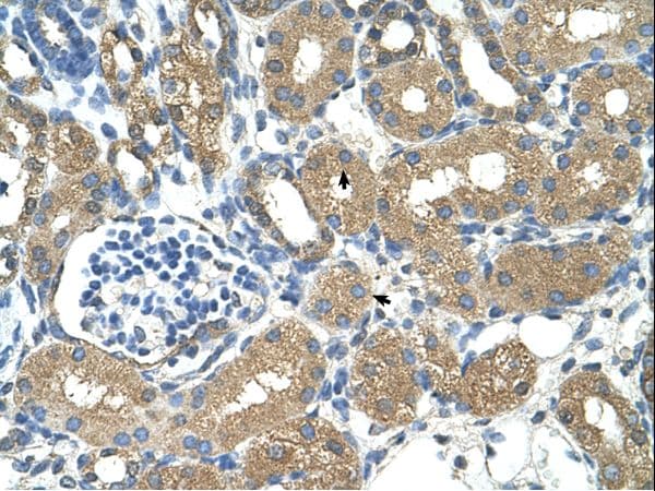 ADH4 Antibody (aa108-157)
