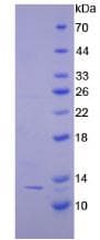 Human CTNNBIP1 / ICAT Protein (Recombinant His-T7)