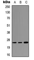 Polyclonal Rabbit anti-Human SFTPA1 / Surfactant Protein A Antibody (Internal, WB)