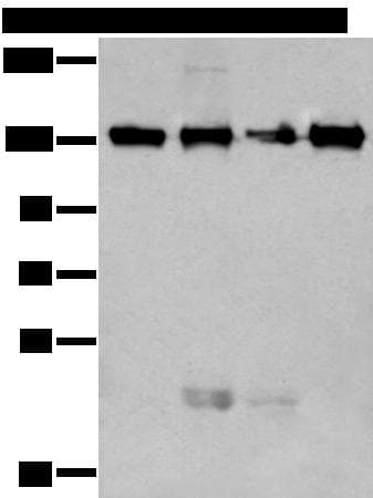 MORC2 Antibody