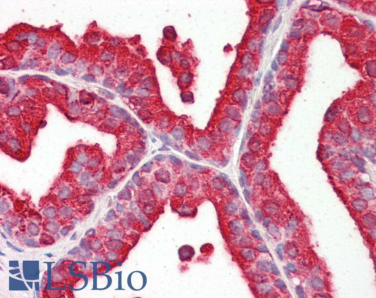 IHC-plus™ Polyclonal Rabbit anti-Human Acid Phosphatase Antibody (IHC, IF, WB)