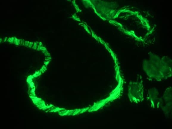 IHC-plus™ Monoclonal Mouse anti-Human Muscle Actin Antibody (clone HHF35, IHC, WB)