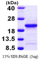 Human PFDN4 Protein (Recombinant His)