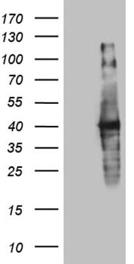Monoclonal Mouse anti-Human UPRT Antibody (clone OTI1D12, Carrier-free, IHC, WB)