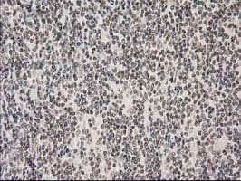 PRKCE / PKC-Epsilon Antibody (clone OTI2A12)