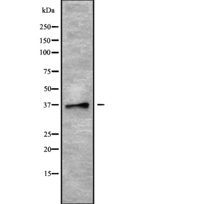 Polyclonal Rabbit anti-Human PLSCR4 Antibody (WB)