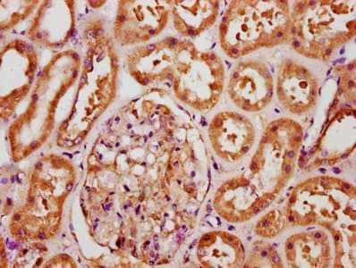 FGF1 / Acidic FGF Antibody (aa16-155)