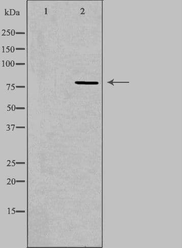 Polyclonal Rabbit anti-Human CEP78 / IP63 Antibody (IHC, IF, WB)
