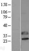C1QTNF2 / CTRP2 Protein (Over-Expression Lysate Myc-DDK (Flag))
