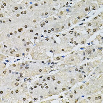 Polyclonal Rabbit anti-Human H2AFZ / H2A.z Antibody (IHC, WB)