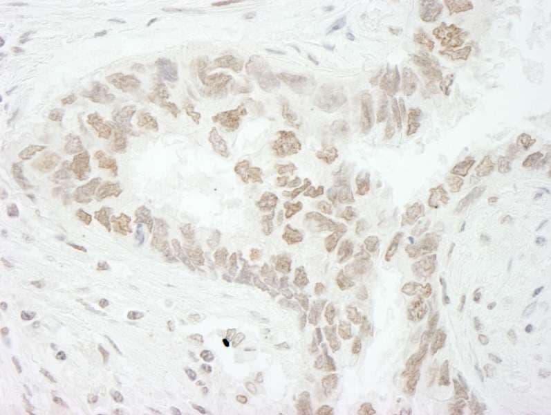 Polyclonal Rabbit anti-Human CD3EAP Antibody (aa404-454, IHC, IF)