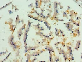 RICK / RIP2 Antibody (aa1-540)