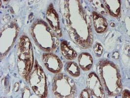 PPAT Antibody (aa42-278, clone OTI1B8)