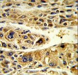 ADH6 Antibody (aa209-240)