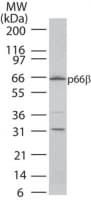 Polyclonal Rabbit anti-Mouse GATAD2B Antibody (aa445-460, WB)