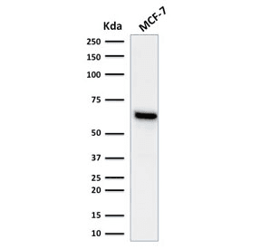 ER Alpha / Estrogen Receptor Antibody (clone ESR1/1935)