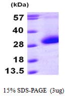 Human CDKN3 / KAP Protein (Recombinant His)