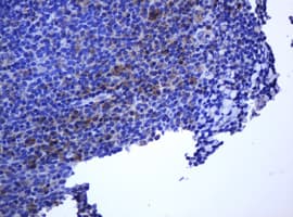 TCL / RHOJ Antibody (clone OTI2C11)