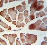 PATL1 Antibody (aa489-518)