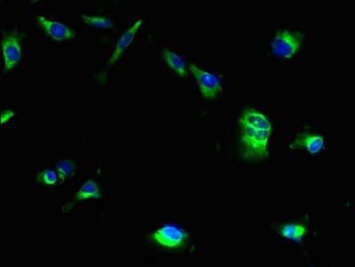 Polyclonal Rabbit anti-Human MRAP2 Antibody (WB)