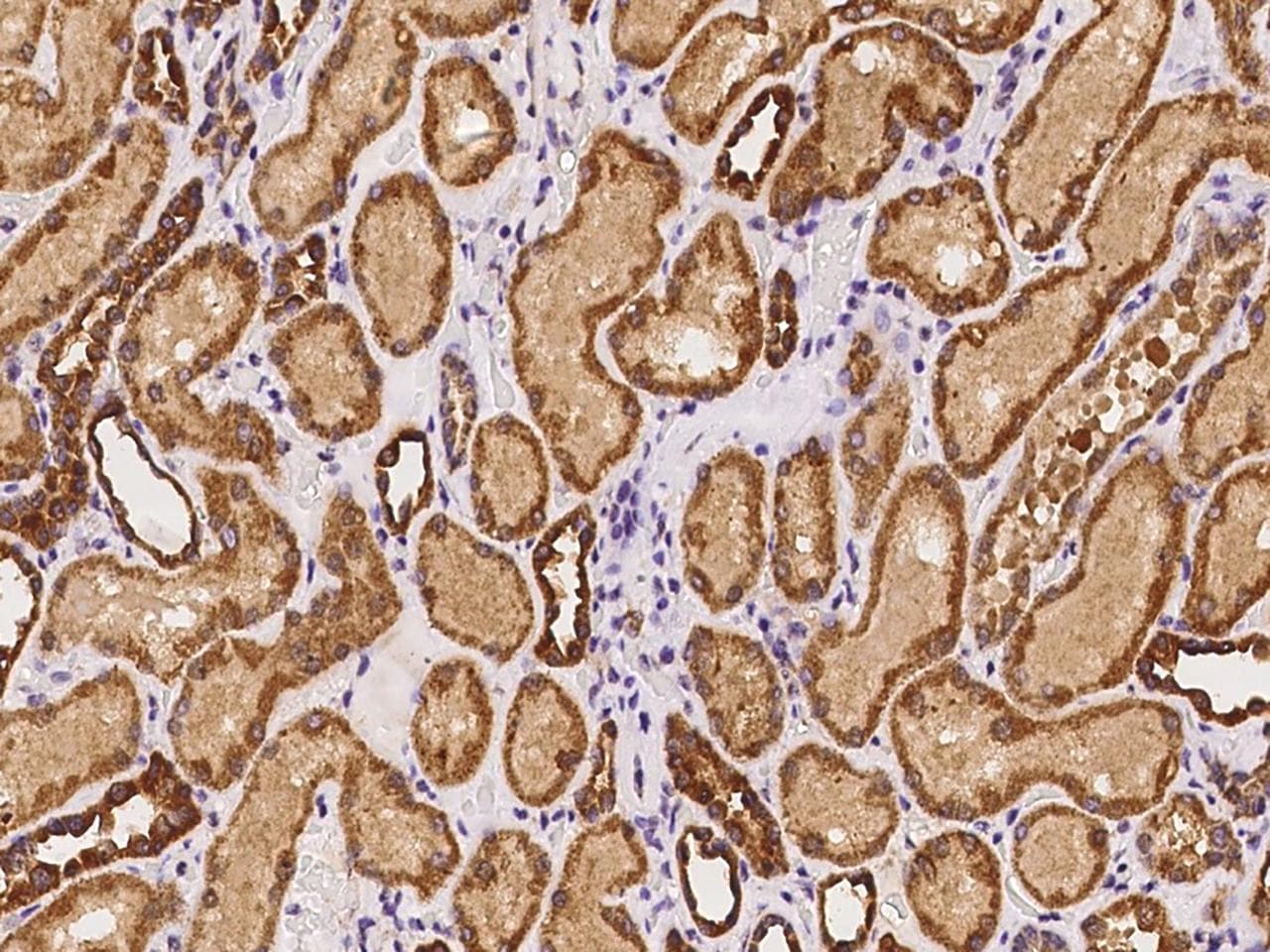 ADCY5 / Adenylate Cyclase 5 Antibody