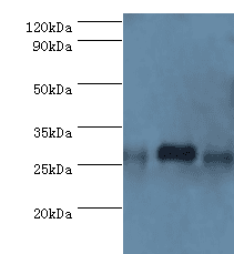 BCL10 / BCL-10 Antibody (aa1-233)