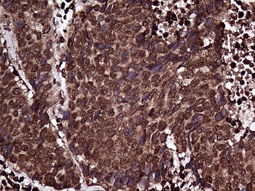 Monoclonal Mouse anti-Human RPL10A Antibody (clone OTI2G9, IHC, WB)