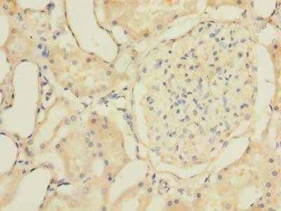Polyclonal Rabbit anti-Human ZNF707 Antibody (IHC)
