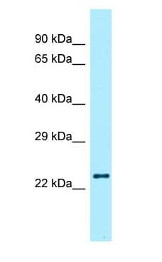 RLN2 / Relaxin 2 Antibody (aa110-159)