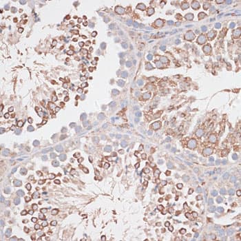 KDM8 / JMJD5 / FLJ13798 Antibody
