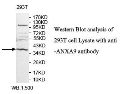 Polyclonal Rabbit anti-Human ANXA9 Antibody (aa131-338, WB)