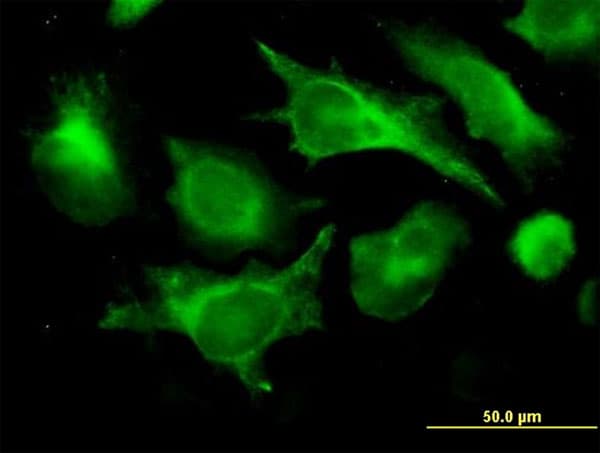 IHC-plus™ Monoclonal Mouse anti-Human B2M / Beta 2 Microglobulin Antibody (clone 3F9-2C2, IHC, IF, WB)