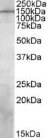 IHC-plus™ PREX1 / P-REX1 Antibody (aa1514-1526)