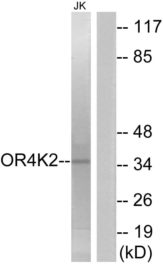 OR4K2 Antibody (aa265-314)