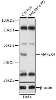 Polyclonal Rabbit anti-Human MAP2K4 / MKK4 Antibody (IHC, WB)