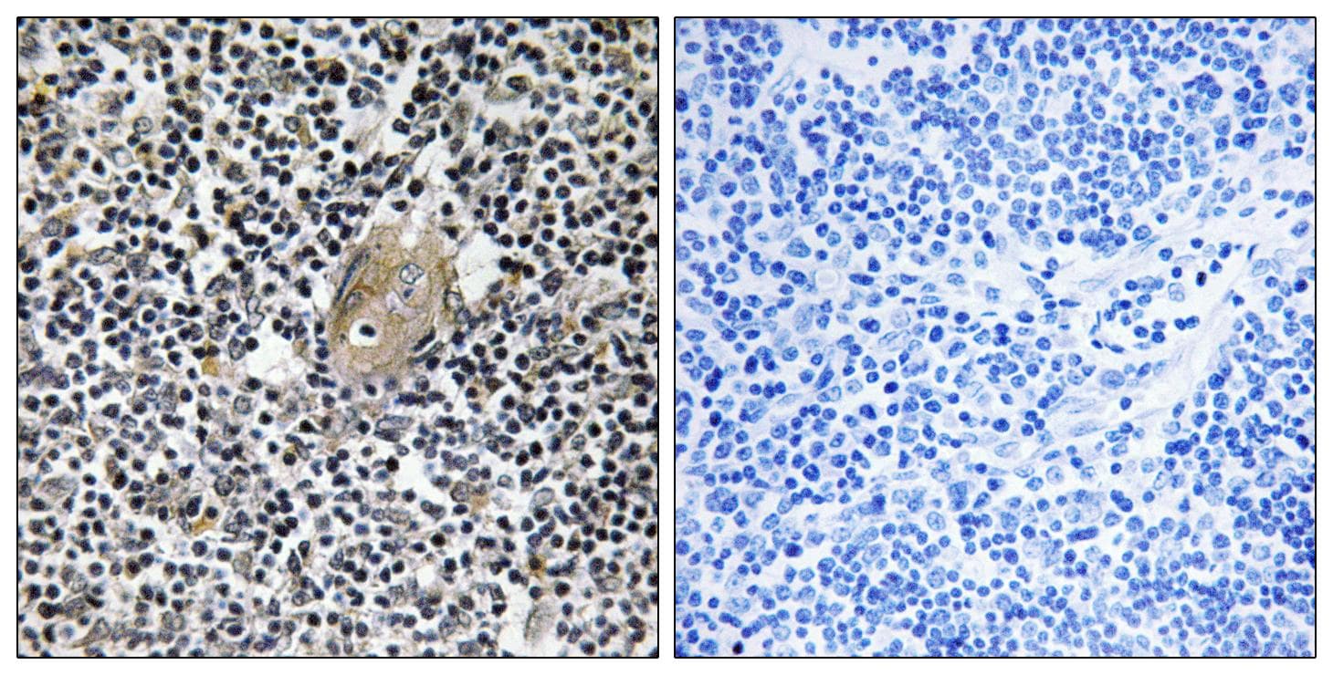 ZAP70 Antibody (phospho-Tyr493)